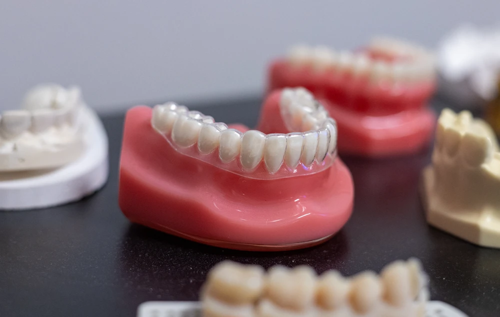 Dental teeth model display for treatment explanation in creedmoor road dental office