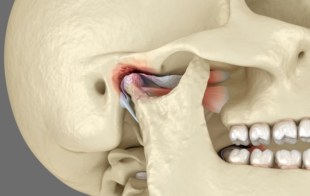 Anatomy Closeup of Temporomandibular Joint