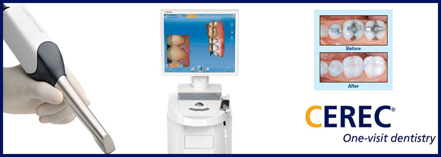 Cerec One Visit Dentistry
