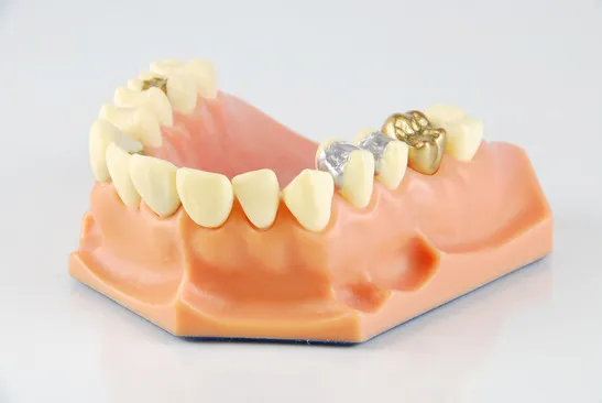Dental Model With DifferentTreatments