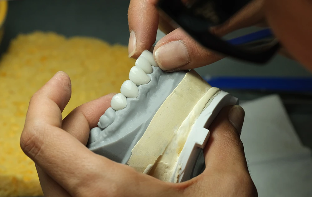 Dentist Crafting Porcelain Veneers