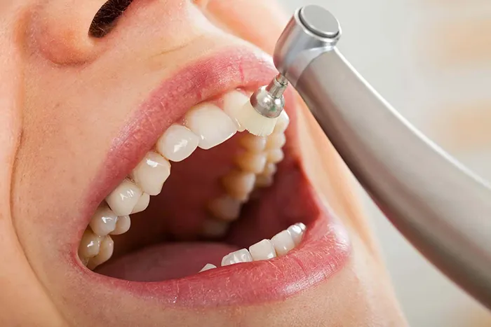 The Surprising Health Benefits Of Regular Dental Cleanings