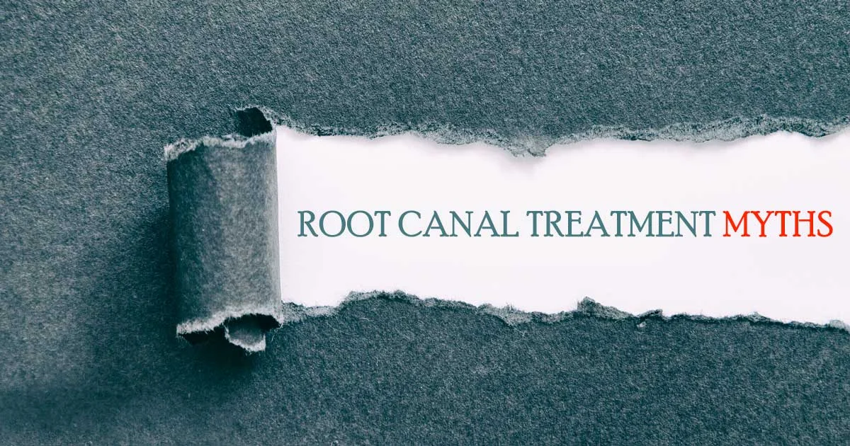 root canal myths