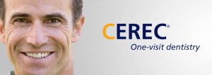 CEREC Same Day Dental Crowns